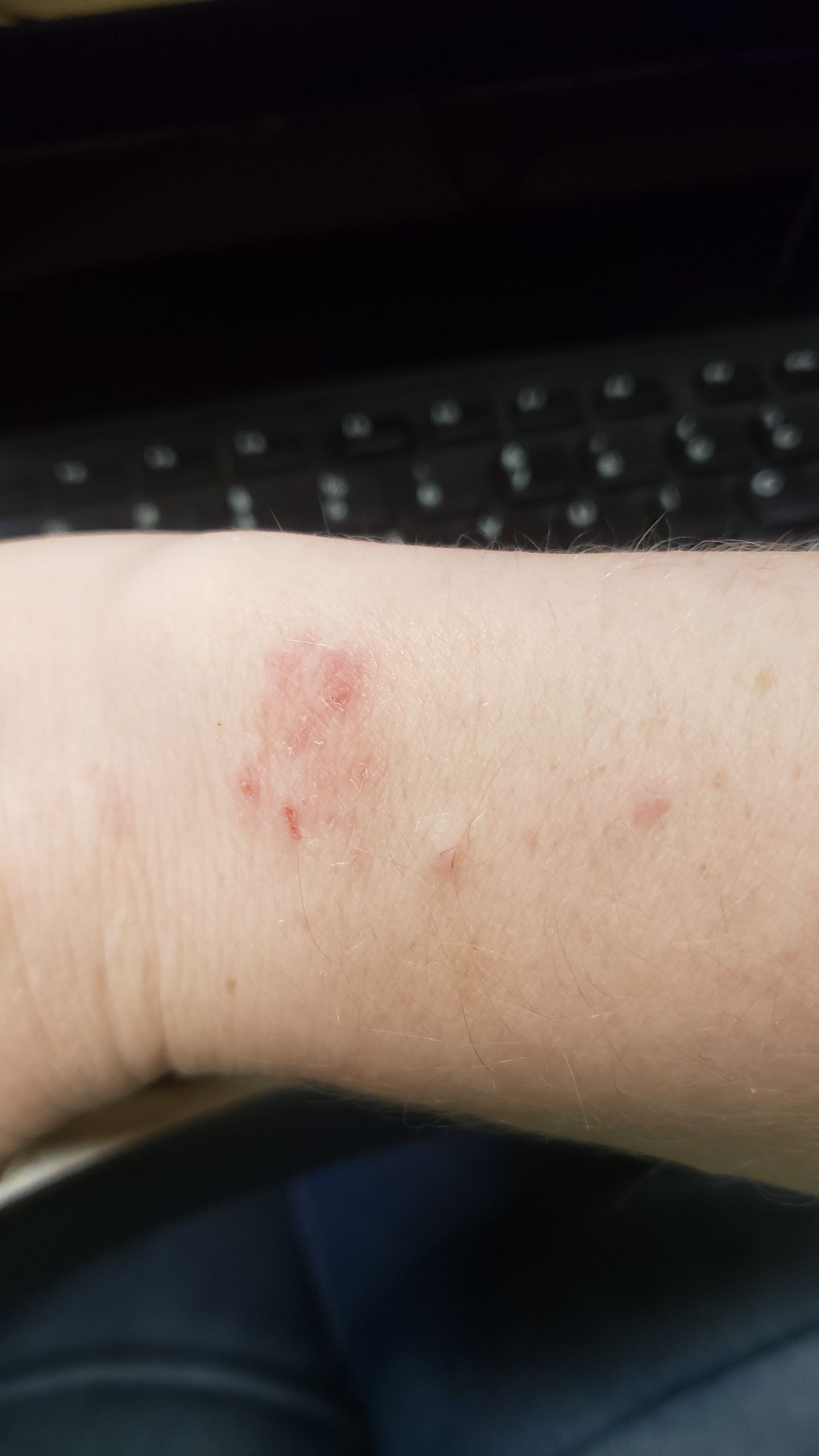 fitbit versa 3