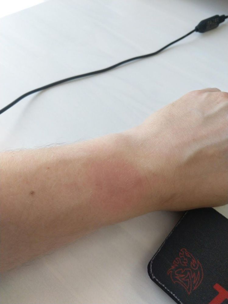 fitbit arm brand.jpg