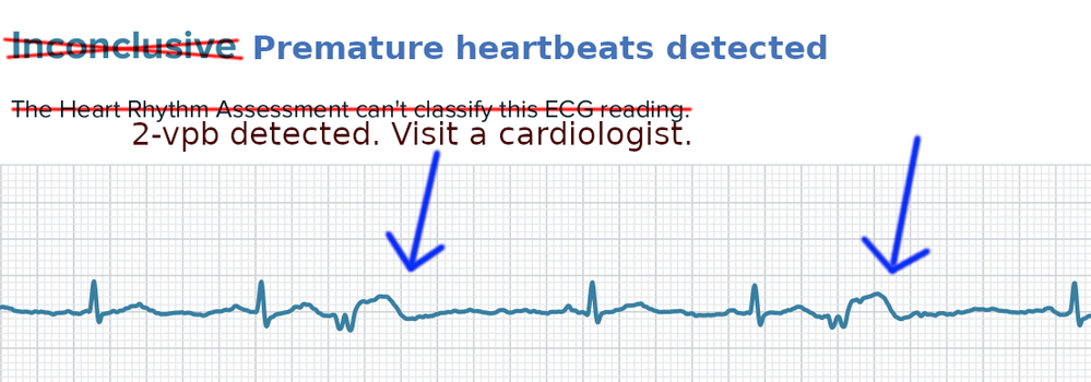 Fitbit with clearance ecg