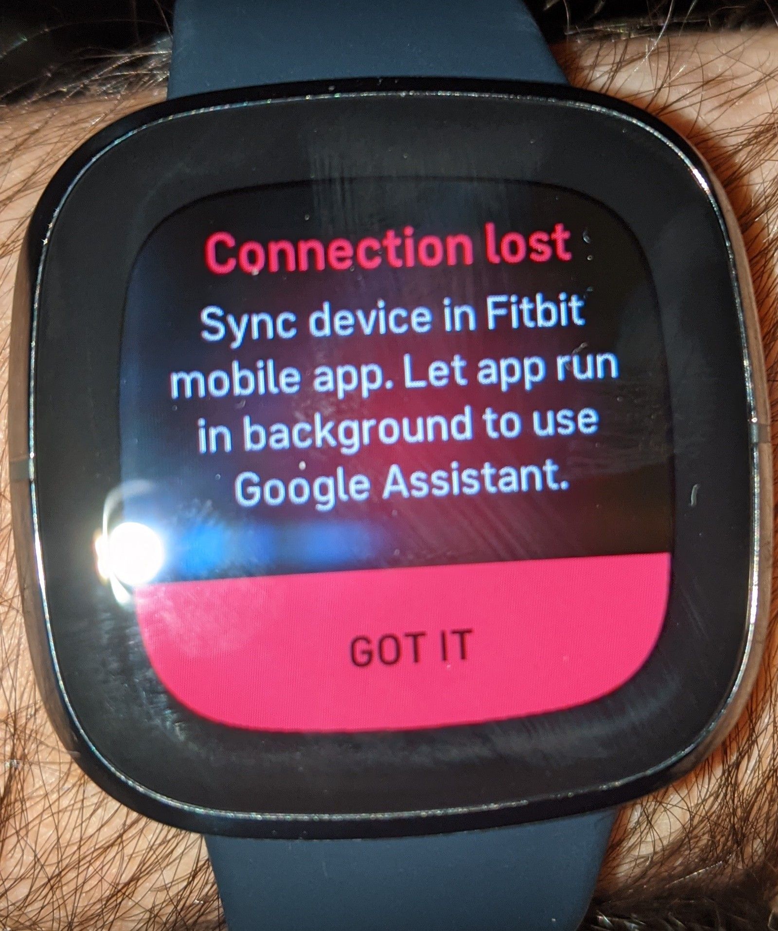 lost fitbit versa