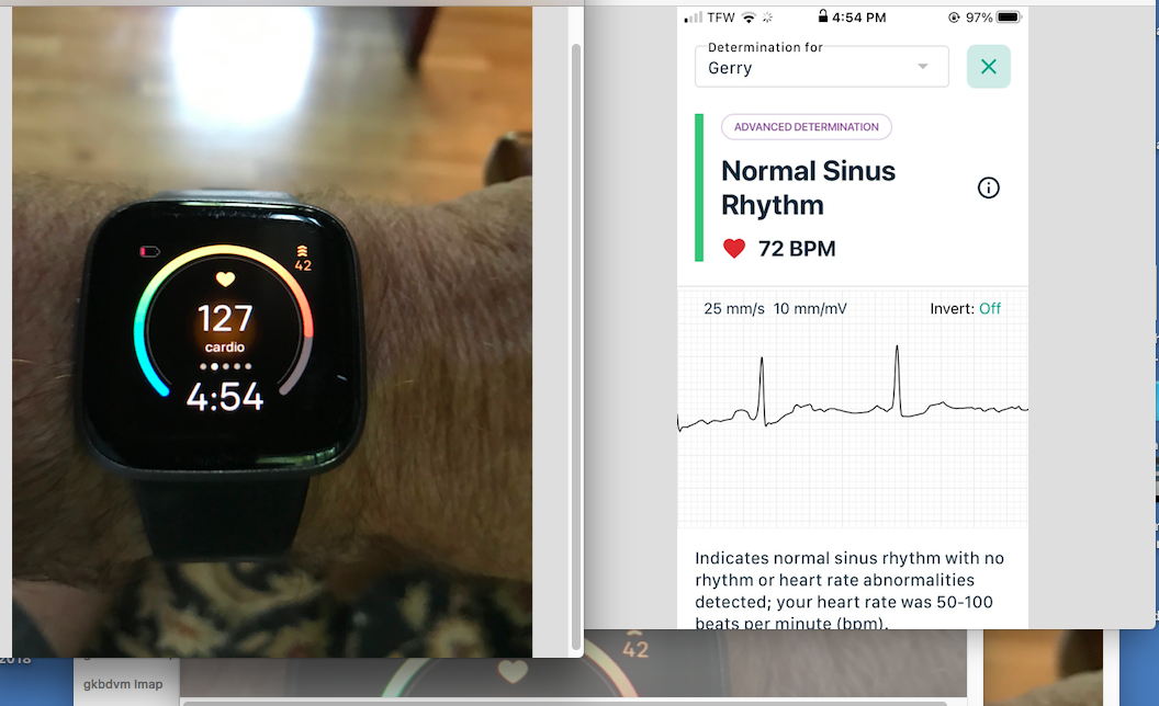 Fitbit versa 2 sales heart rate