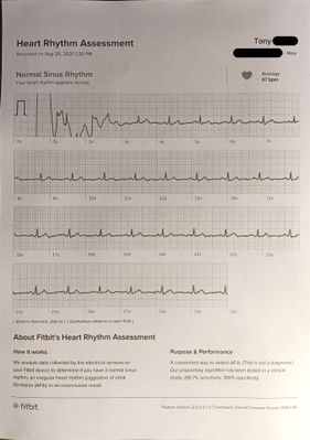 ECG - 20210825.jpg