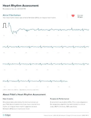 Fitbit discount heart rhythm