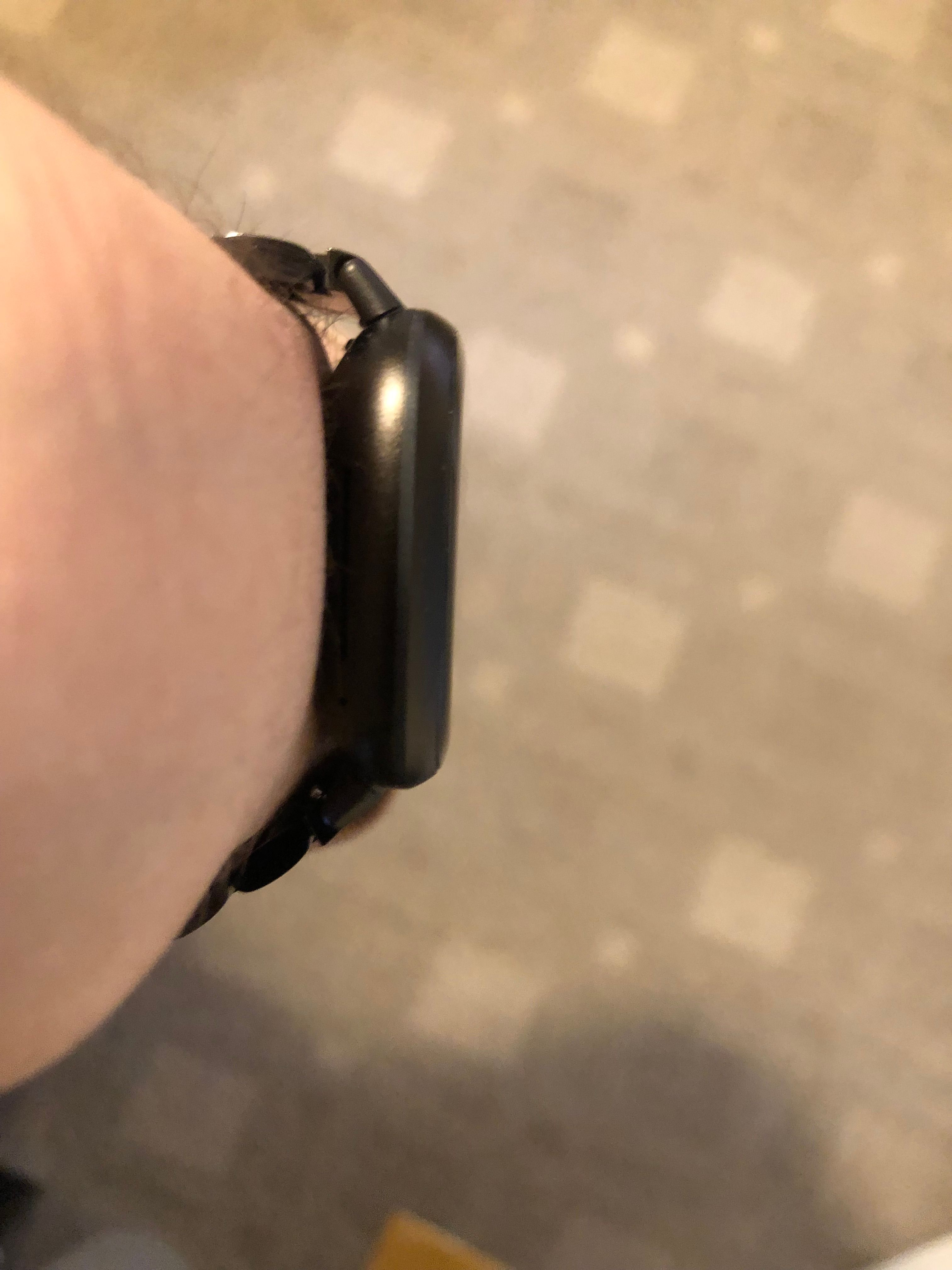 My fitbit band discount broke