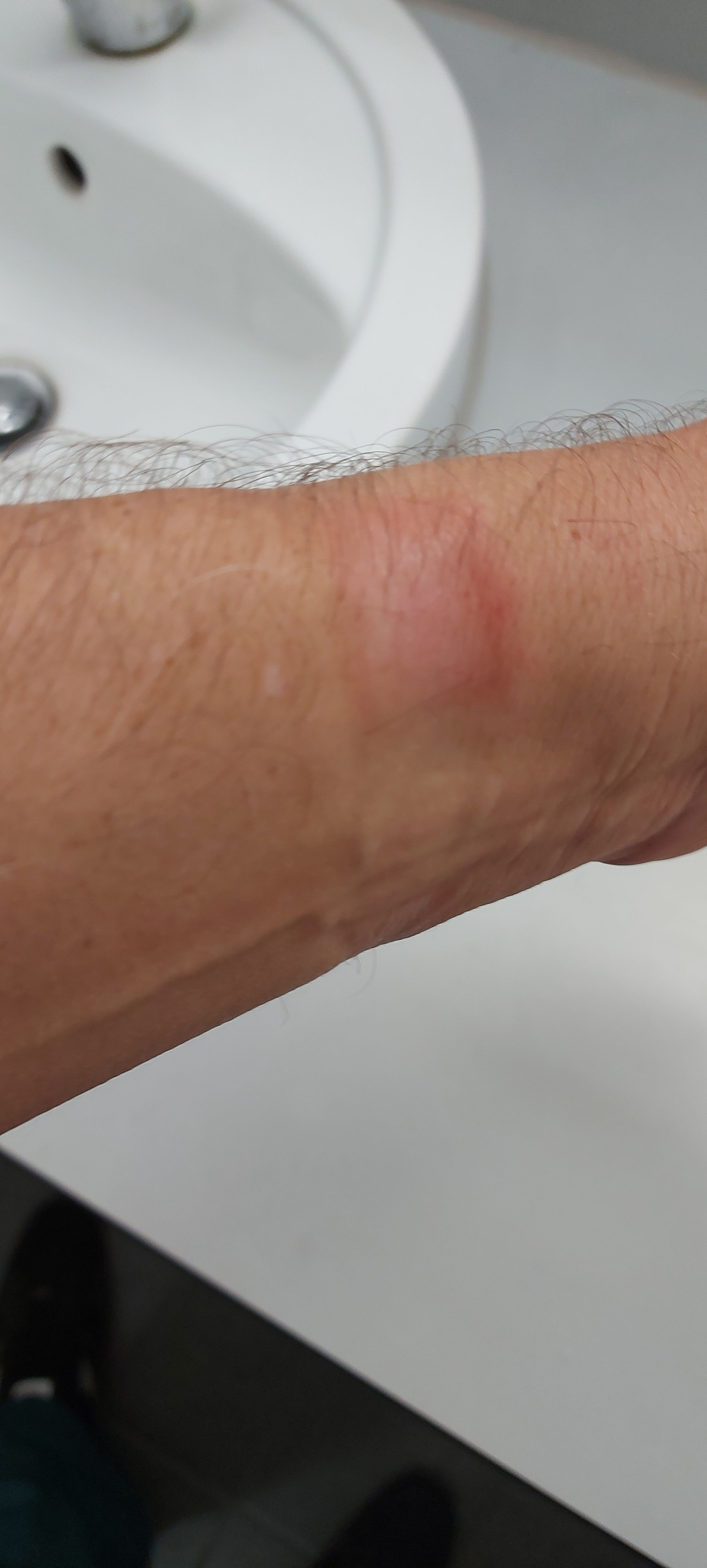 Andere Plätze stimulieren Sirene fitbit charge 5 armband allergie