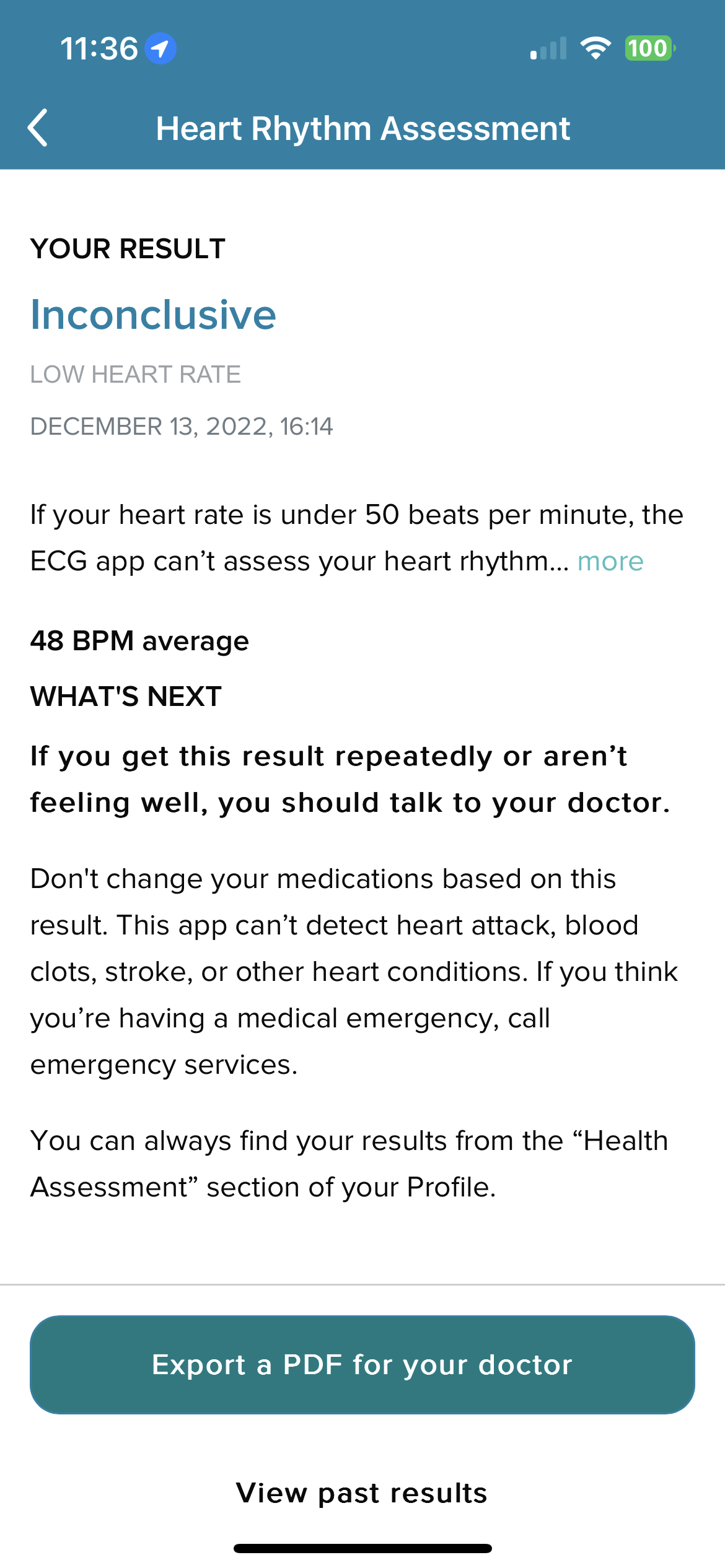 Apple watch ecg online always inconclusive