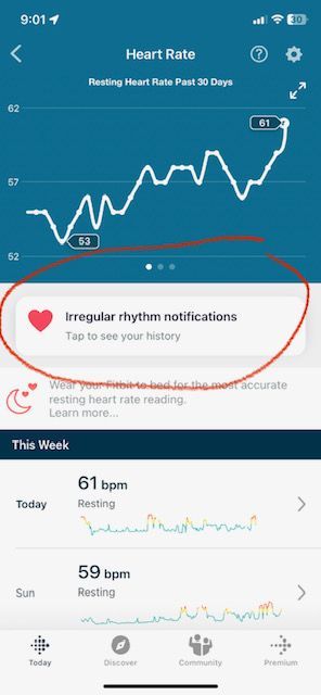 Fitbit irregular heart online rate