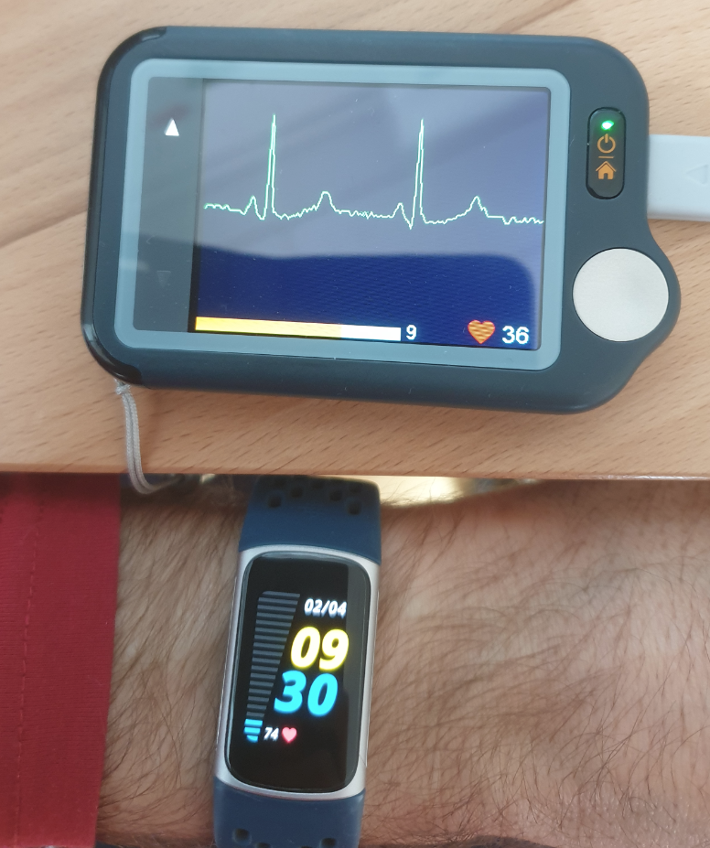 ecg_vs_fitbit_2.png