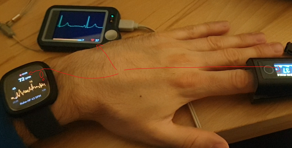 ecg_vs_fitbit.png