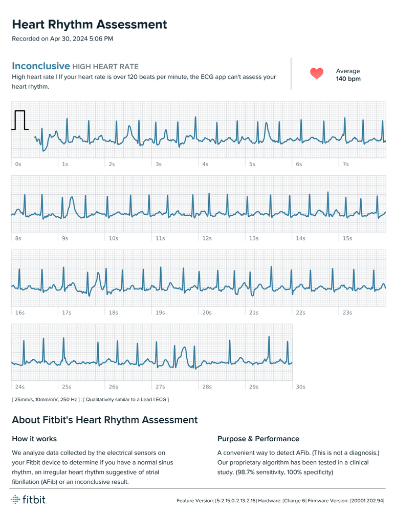 ECG_April_30.png