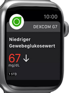 Watch BZDexcom.PNG