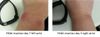 Fitbit metal reaction pictures.jpg