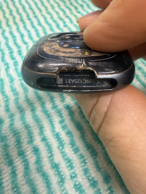 broken band connector