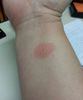 fitbit right wrist day 2 underside.JPG