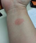 fitbit right wrist day 2 underside.JPG