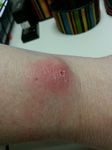 fitbit left wrist day 16.2.jpg