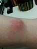 fitbit left wrist day 16.2.jpg