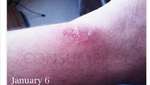 First noticed on 1/10/14