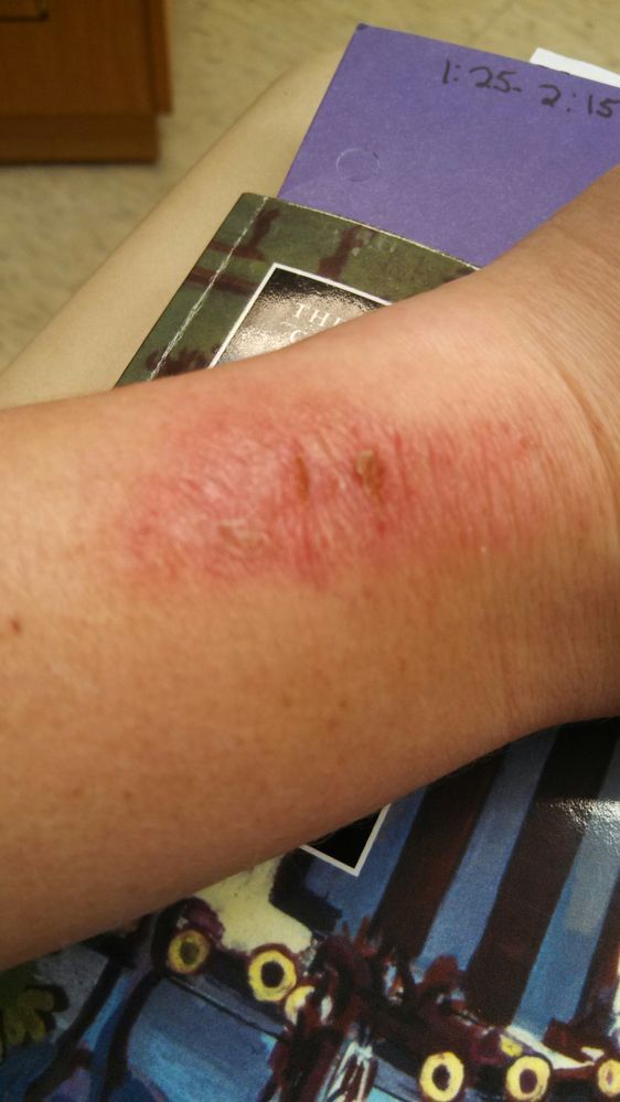 left wrist