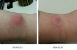 healing progress 2014.01.20.jpg