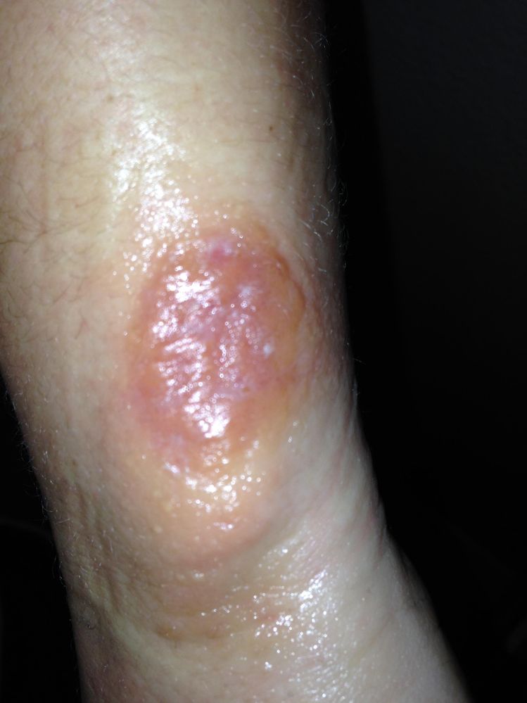 photo 4.JPG