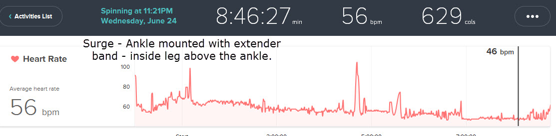 Surge ankle sleep.jpg