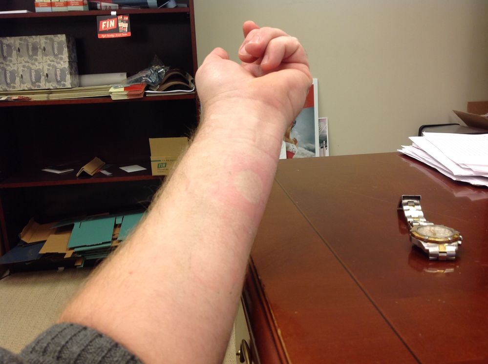 tape off 14 hours.jpg