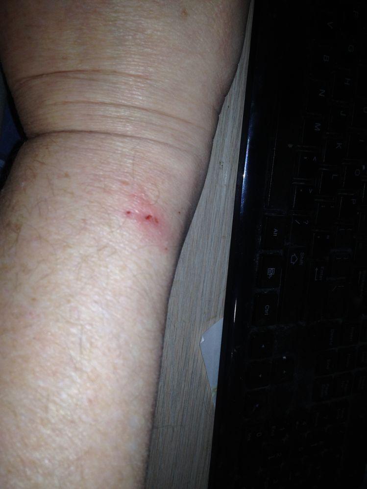 right arm 2 months
