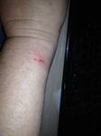 right arm 2 months