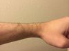 Left hand which Stainless Steel backed watch has been on other than for these photos for 3 years 24/7 including in the shower