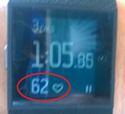 fitbit-surgehr.jpg
