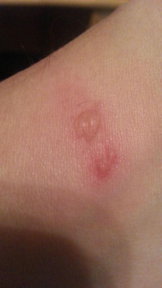20140120_fitbitBurn.jpg