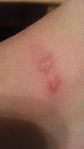 20140120_fitbitBurn.jpg