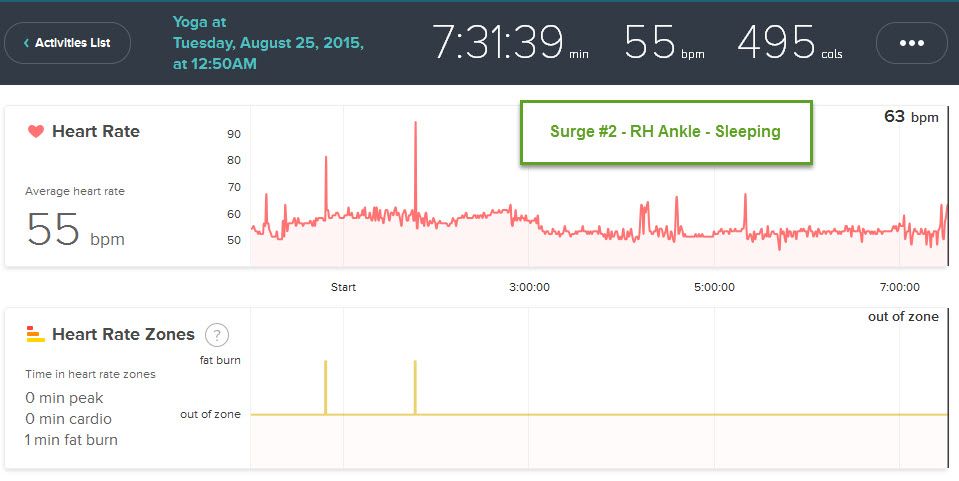 Surge 2 Ankle Sleeping.jpg