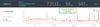 Surge wrist  sleep 15-08-25.jpg