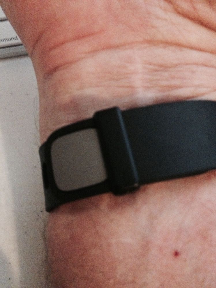 Force Band