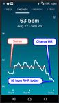 Surge Charge HR RHR.jpg