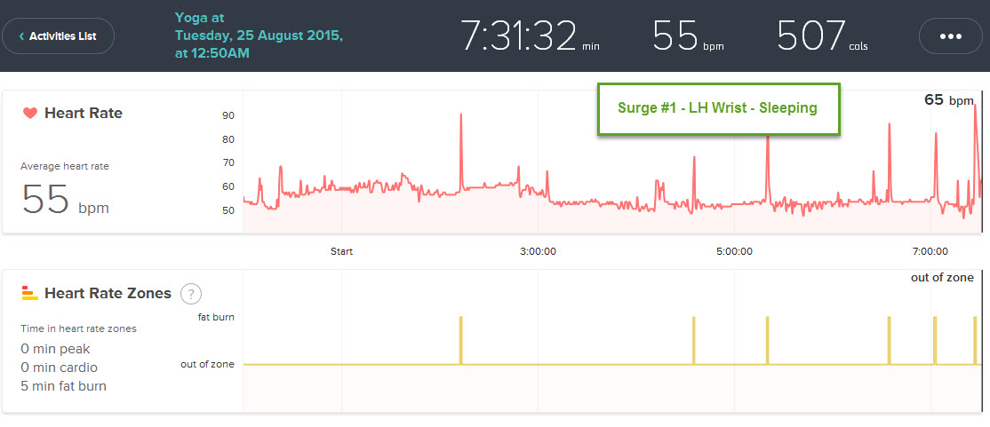 Surge 1 Wrist sleep 15-08-27.jpg