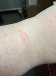 fitbit burn