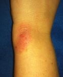 Left Wrist 2-1-14.JPG