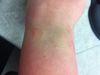 Right Wrist 1-23-14.JPG