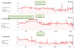 blaze v Charge HR.jpg