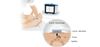 transcutaneous-oximetry-tcpo2-tcom.jpg