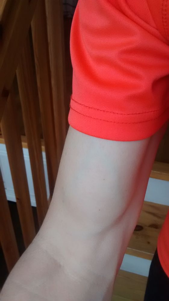 arm_veins.jpg