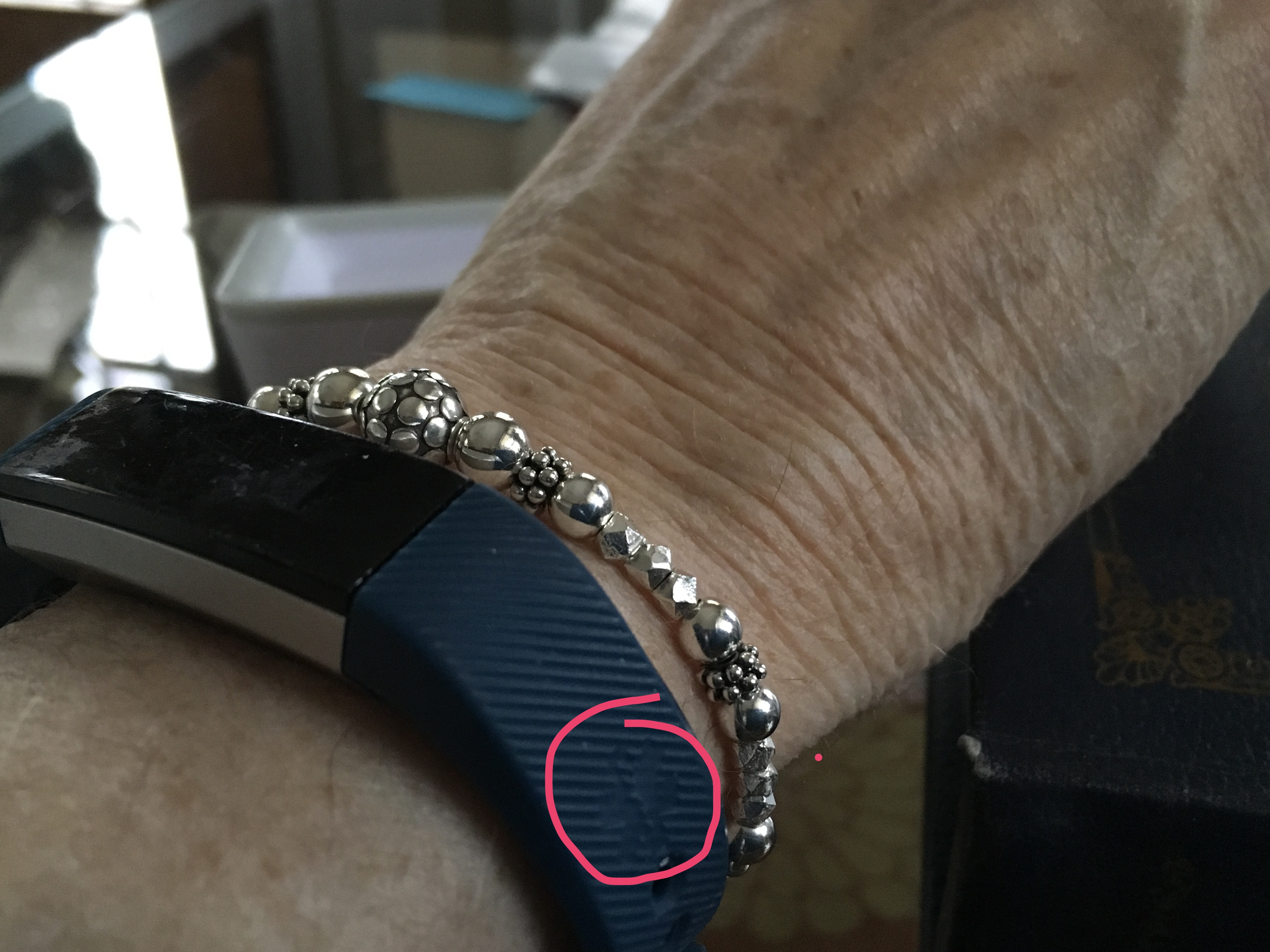 fitbit with medical alert