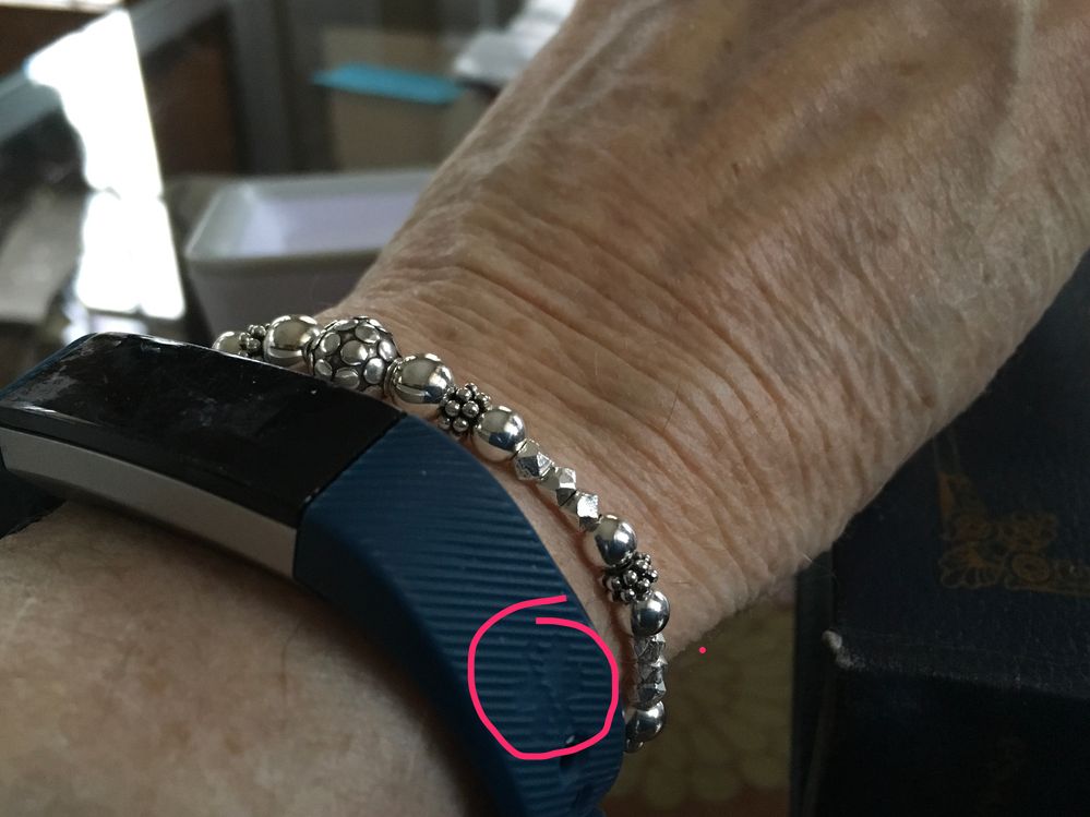 fitbit medical alert bracelet