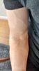veins on arm.jpg