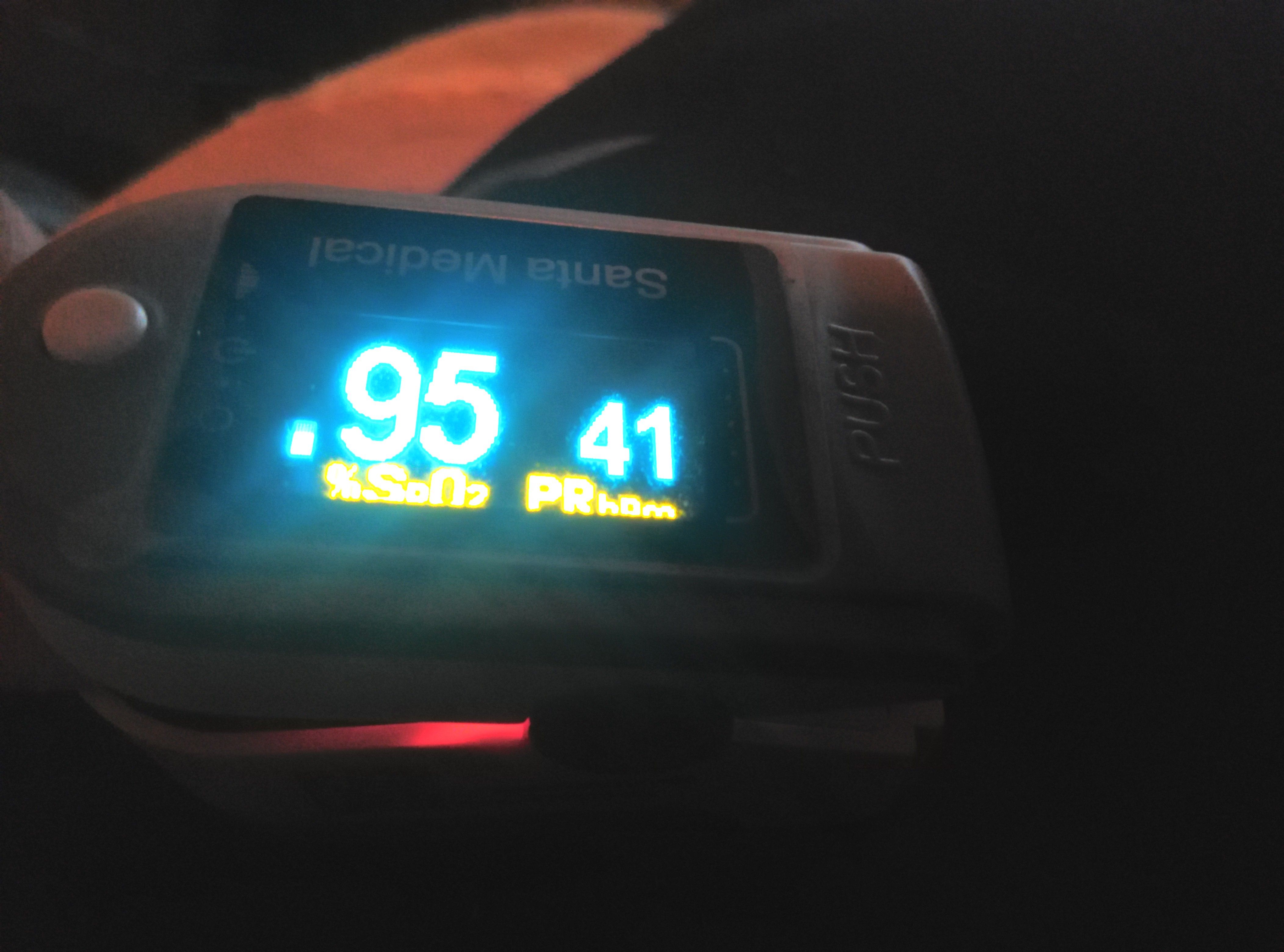 Low resting heart rate (too low?) Page 2 Fitbit Community