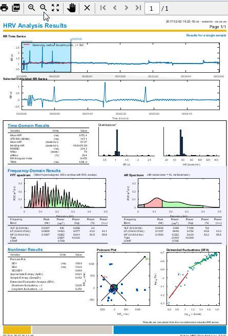 Kubios HRV.jpg