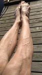 veins_on_legs_8-2017.jpg